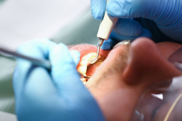 Best Cosmetic Emergency Dentistry in Prosperity, SC