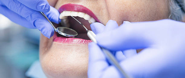 Best Emergency Gum Treatment in Prosperity, SC